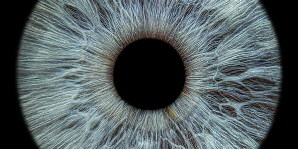 Eye catch