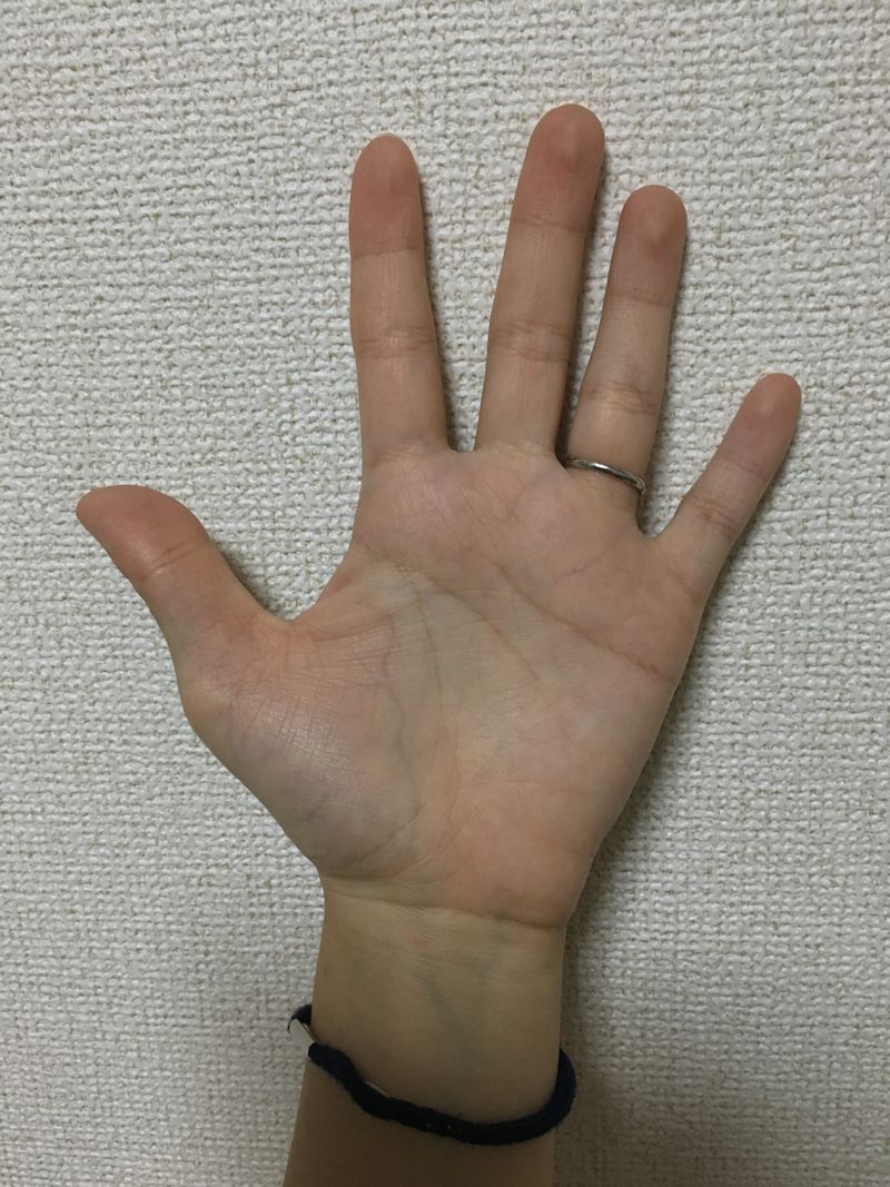 Content image